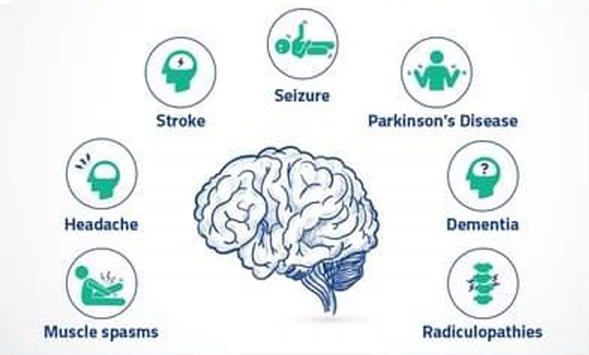 Neurological Disorder